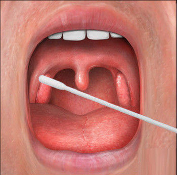 TDS Flocked Sterile Medical Swabs Nasopharyngeal Throat Swab Plypropylene Handle